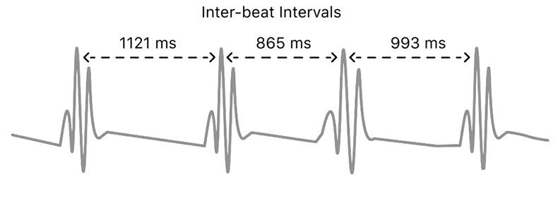 What is heart rate variability (HRV)? What is the use of HRV
